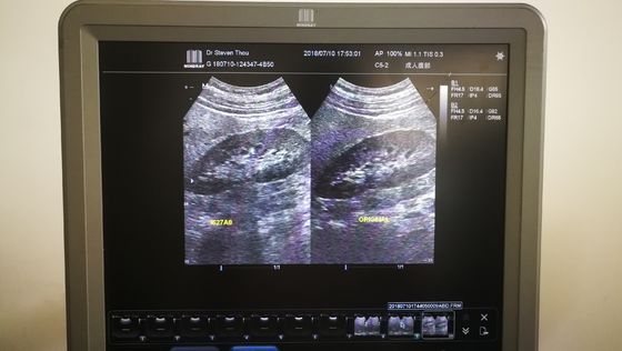 Ultrasone Convex Probe Compatibel met Mindray C5-2 DC-7/N6/T6 Ultrasone scanner